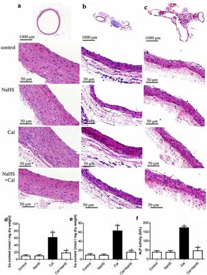 Hydrogen Sulfide Facilitates the Impaired Sensitivity of Carotid Sinus Baroreflex in Rats with Vascular Calcification